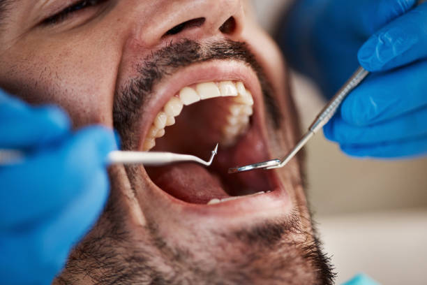 Best Broken or Cracked Tooth Emergency Dentist in Albany, OR