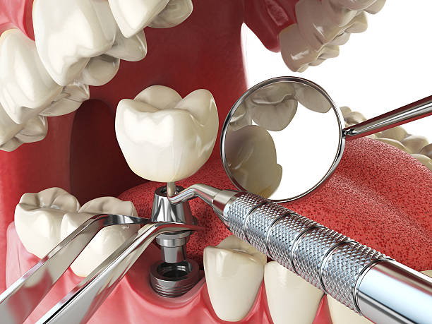 Best Emergency Dental Services for Seniors in Albany, OR